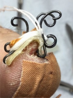 陥入爪